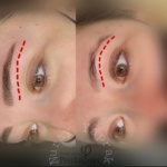 Nuray Yaprak tarafından yapılan microblading işlemiyle kaşlarda doğal ve dolgun görünüm elde edilmiştir. Microblading öncesi ve sonrası kaş görünümü – Nuray Yaprak Beauty Studio İzmir