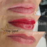 Dolgun görünüm ve belirgin dudak hatları İzmir Karşıyaka dudak kontürü ve renklendirme öncesi sonrası