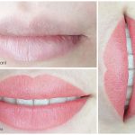 Doğal pembelikte kalıcı dudak rengi İzmir dudak renklendirme öncesi sonrası örneği